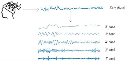 Optimized Projection and Fisher Discriminative Dictionary Learning for EEG Emotion Recognition